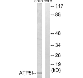 Western Blot - Anti-ATP5I Antibody (C14593) - Antibodies.com