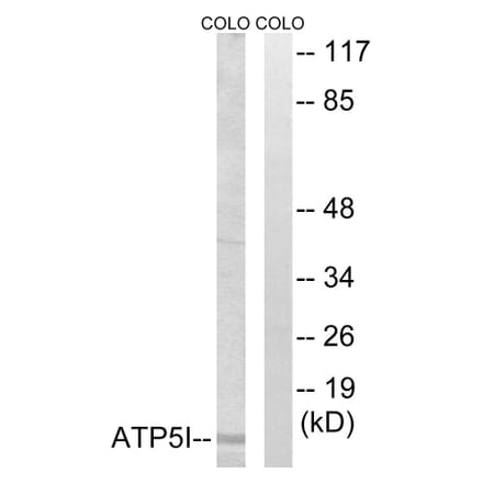 Western Blot - Anti-ATP5I Antibody (C14593) - Antibodies.com