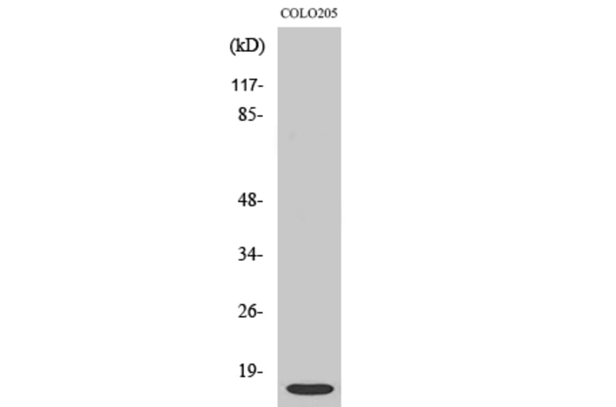 Western Blot - Anti-ATP5I Antibody (C14593) - Antibodies.com