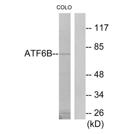 Western Blot - Anti-ATF6B Antibody (C11585) - Antibodies.com