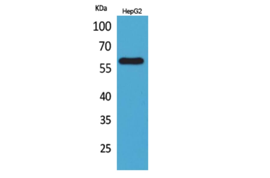 Western Blot - Anti-ASIC3 Antibody (C30145) - Antibodies.com