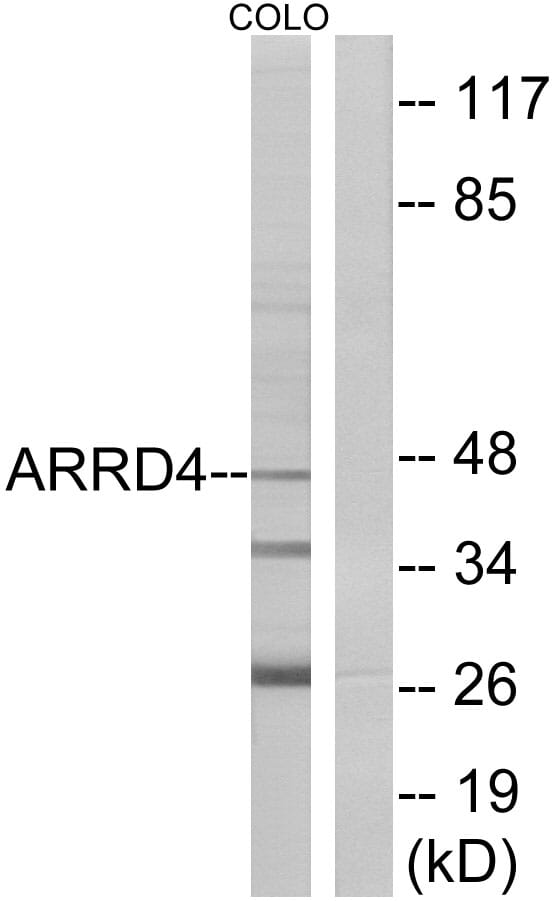 Anti-ARRD4 Antibody (A101213) | Antibodies.com