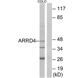 Western Blot - Anti-ARRD4 Antibody (C12062) - Antibodies.com