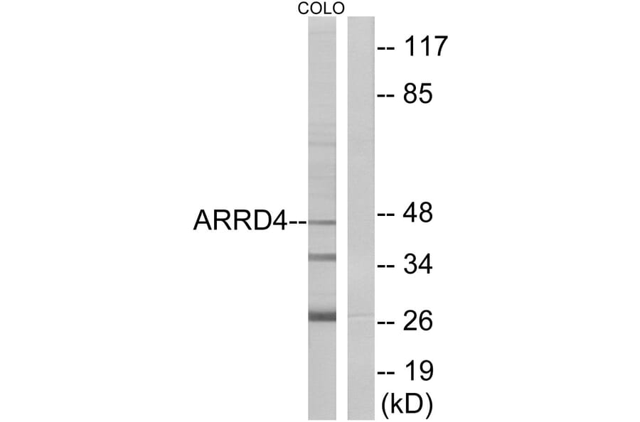 Western Blot - Anti-ARRD4 Antibody (C12062) - Antibodies.com
