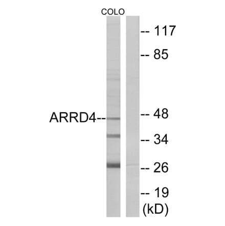Western Blot - Anti-ARRD4 Antibody (C12062) - Antibodies.com
