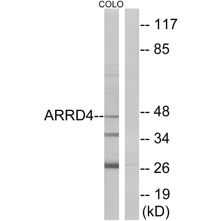 Western Blot - Anti-ARRD4 Antibody (C12062) - Antibodies.com