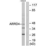 Western Blot - Anti-ARRD4 Antibody (C12062) - Antibodies.com