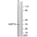 Western Blot - Anti-AQP12 Antibody (C14549) - Antibodies.com