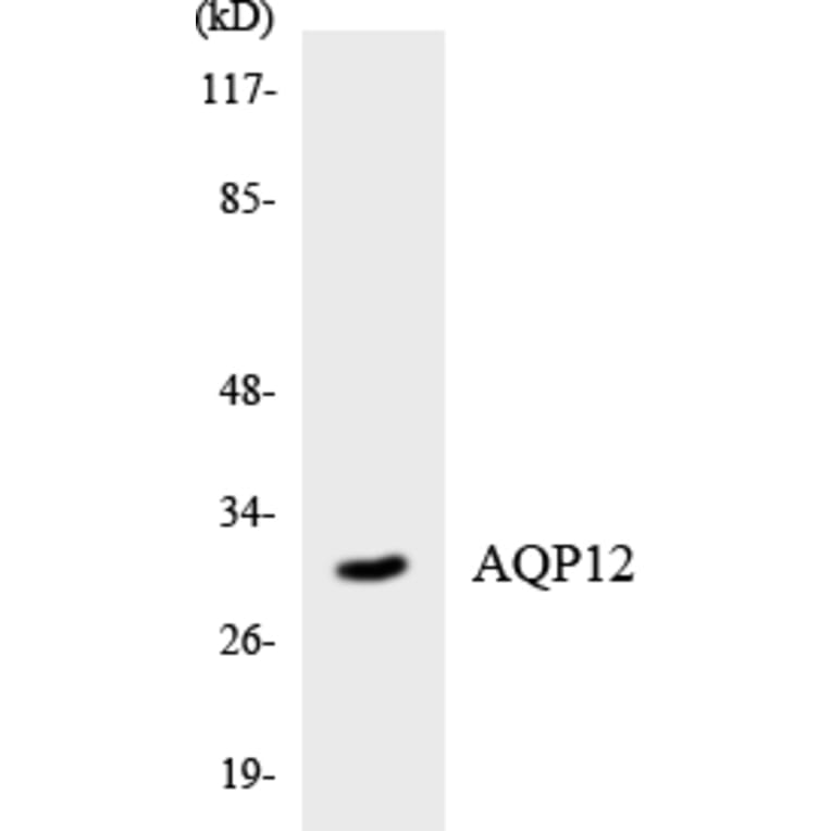 Western Blot - Anti-AQP12 Antibody (R12-2499) - Antibodies.com