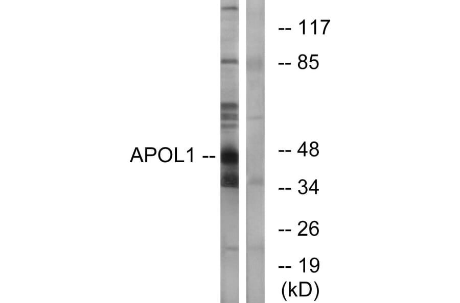 Western Blot - Anti-APOL1 Antibody (C14539) - Antibodies.com