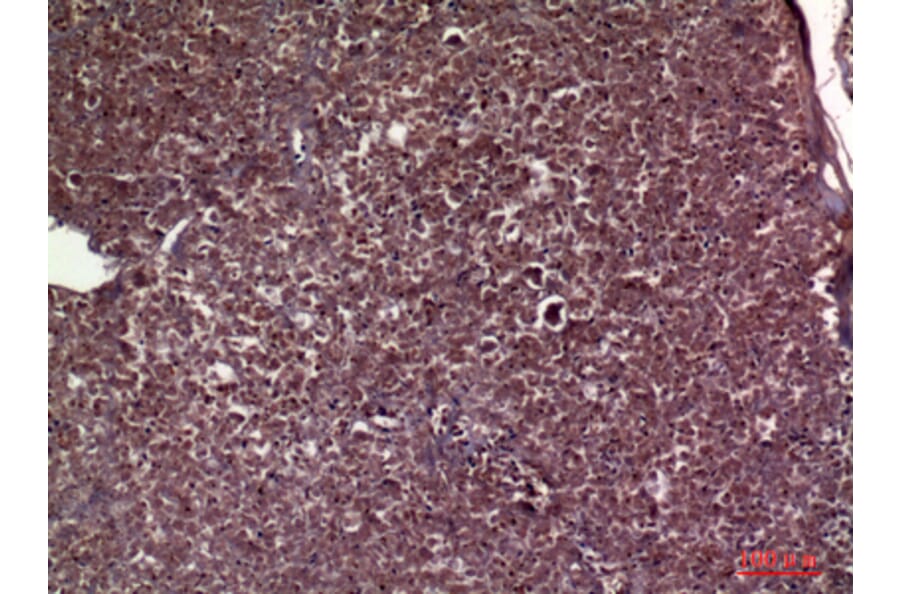 Immunohistochemistry - Anti-APOC3 Antibody (C30070) - Antibodies.com