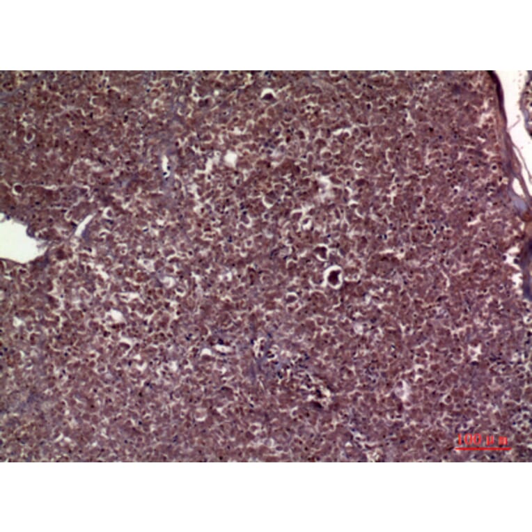 Immunohistochemistry - Anti-APOC3 Antibody (C30070) - Antibodies.com