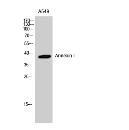 Western Blot - Anti-ANXA1 Antibody (B8290) - Antibodies.com