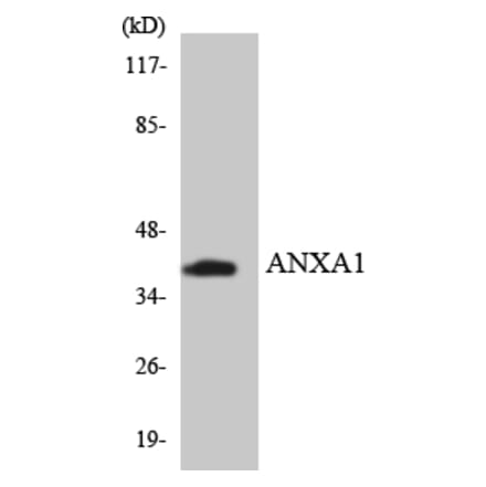 Western Blot - Anti-ANXA1 Antibody (R12-2488) - Antibodies.com