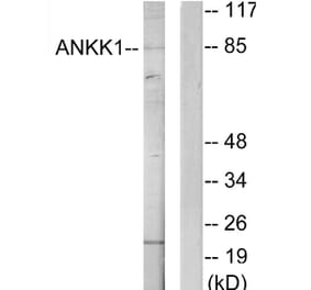 Western Blot - Anti-ANKK1 Antibody (C11372) - Antibodies.com