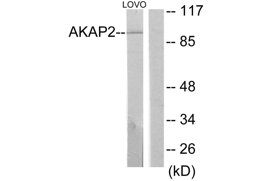 Western Blot - Anti-AKAP2 Antibody (C11932) - Antibodies.com