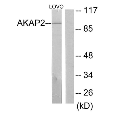 Western Blot - Anti-AKAP2 Antibody (C11932) - Antibodies.com