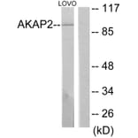 Western Blot - Anti-AKAP2 Antibody (C11932) - Antibodies.com