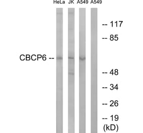 Western Blot - Anti-AGBL4 Antibody (C15302) - Antibodies.com