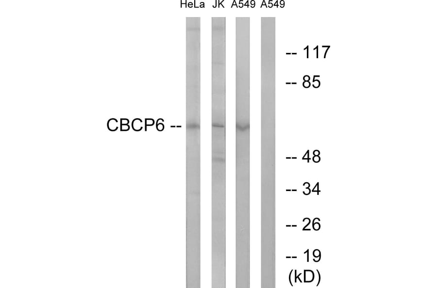 Western Blot - Anti-AGBL4 Antibody (C15302) - Antibodies.com
