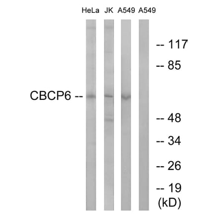 Western Blot - Anti-AGBL4 Antibody (C15302) - Antibodies.com