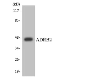 Western Blot - Anti-ADRB2 Antibody (R12-2457) - Antibodies.com