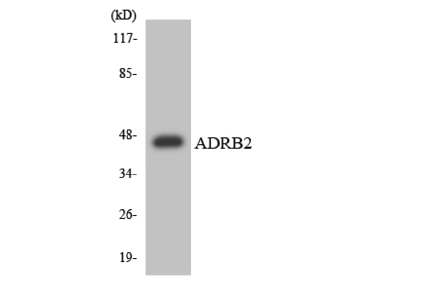Western Blot - Anti-ADRB2 Antibody (R12-2457) - Antibodies.com