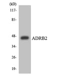 Western Blot - Anti-ADRB2 Antibody (R12-2457) - Antibodies.com