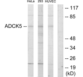 Western Blot - Anti-ADCK5 Antibody (C11156) - Antibodies.com