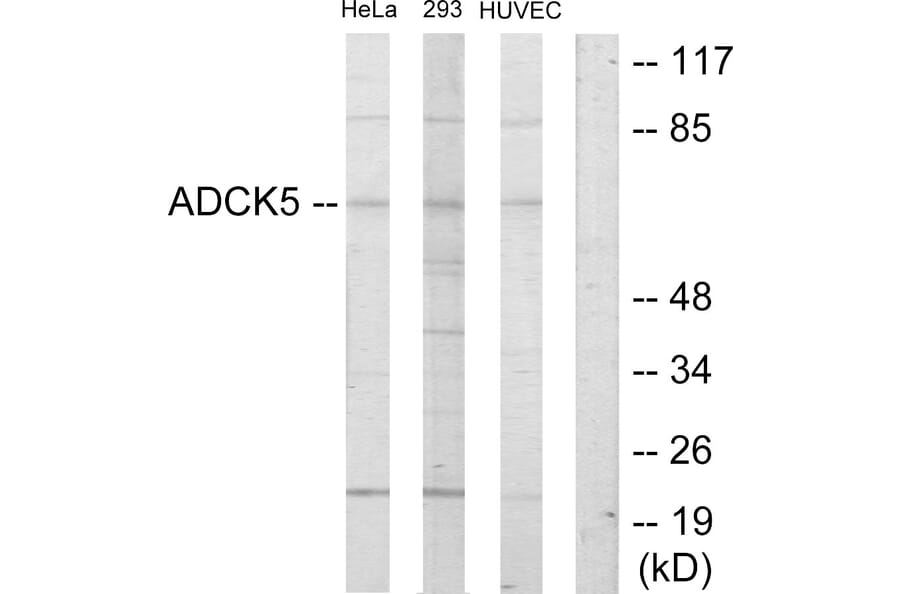 Western Blot - Anti-ADCK5 Antibody (C11156) - Antibodies.com