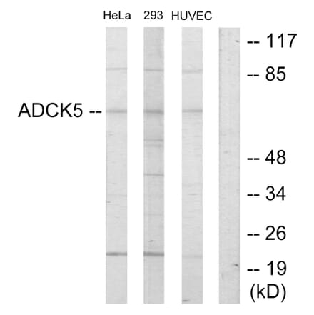 Western Blot - Anti-ADCK5 Antibody (C11156) - Antibodies.com