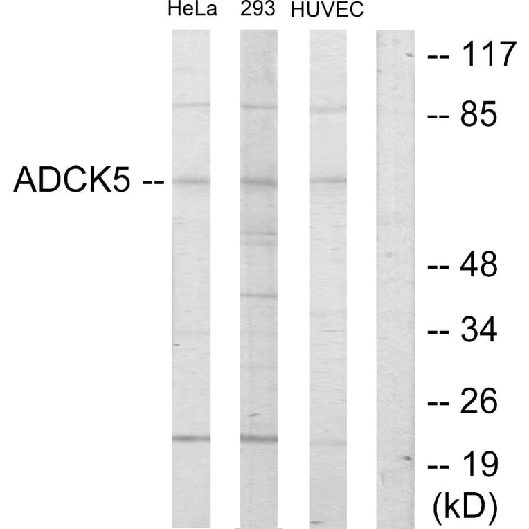 Western Blot - Anti-ADCK5 Antibody (C11156) - Antibodies.com
