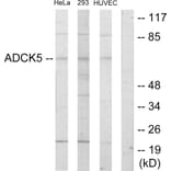 Western Blot - Anti-ADCK5 Antibody (C11156) - Antibodies.com