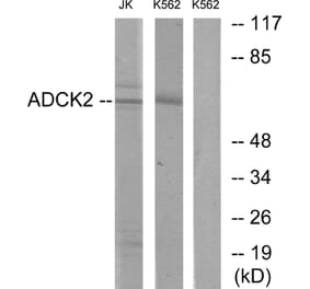 Western Blot - Anti-ADCK2 Antibody (C11266) - Antibodies.com