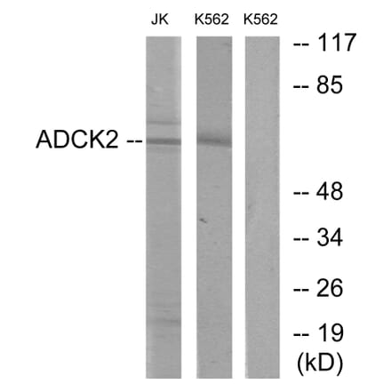 Western Blot - Anti-ADCK2 Antibody (C11266) - Antibodies.com