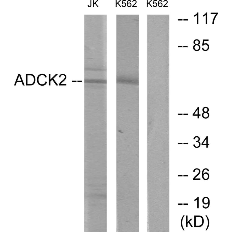 Western Blot - Anti-ADCK2 Antibody (C11266) - Antibodies.com
