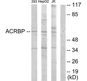 Western Blot - Anti-ACRBP Antibody (C11366) - Antibodies.com