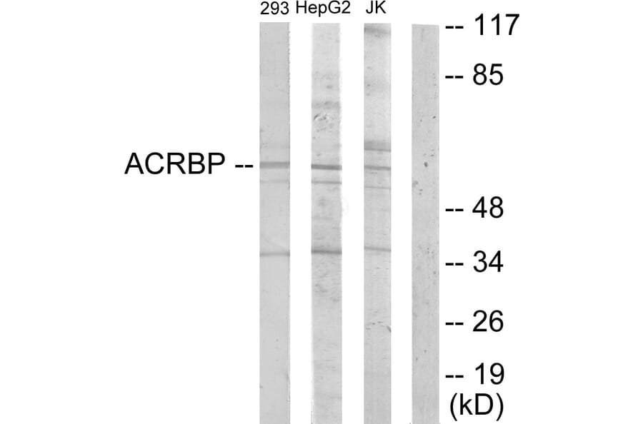 Western Blot - Anti-ACRBP Antibody (C11366) - Antibodies.com