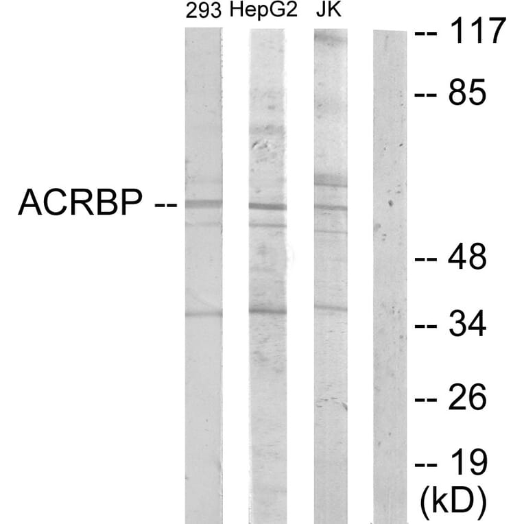 Western Blot - Anti-ACRBP Antibody (C11366) - Antibodies.com