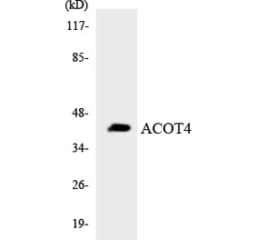 Western Blot - Anti-ACOT4 Antibody (R12-2439) - Antibodies.com