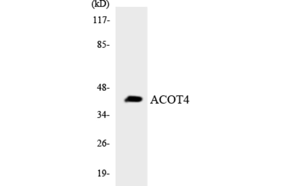 Western Blot - Anti-ACOT4 Antibody (R12-2439) - Antibodies.com