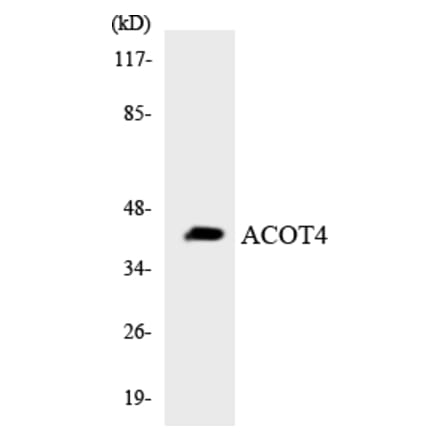 Western Blot - Anti-ACOT4 Antibody (R12-2439) - Antibodies.com