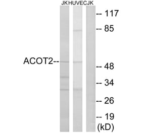 Western Blot - Anti-ACOT2 Antibody (C14271) - Antibodies.com