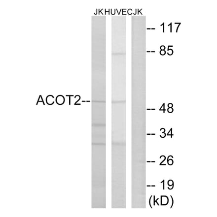 Western Blot - Anti-ACOT2 Antibody (C14271) - Antibodies.com