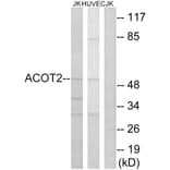 Western Blot - Anti-ACOT2 Antibody (C14271) - Antibodies.com