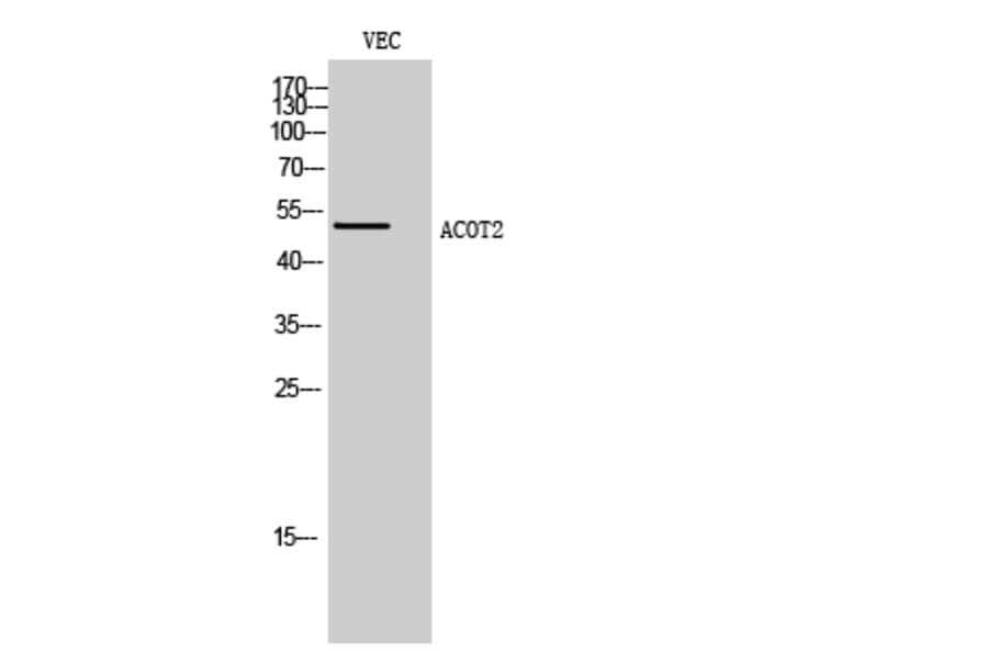 Western Blot - Anti-ACOT2 Antibody (C14271) - Antibodies.com
