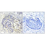 Immunohistochemistry - Anti-ACOT2 Antibody (C14271) - Antibodies.com