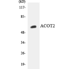 Western Blot - Anti-ACOT2 Antibody (R12-2438) - Antibodies.com