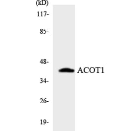 Western Blot - Anti-ACOT1 Antibody (R12-2437) - Antibodies.com