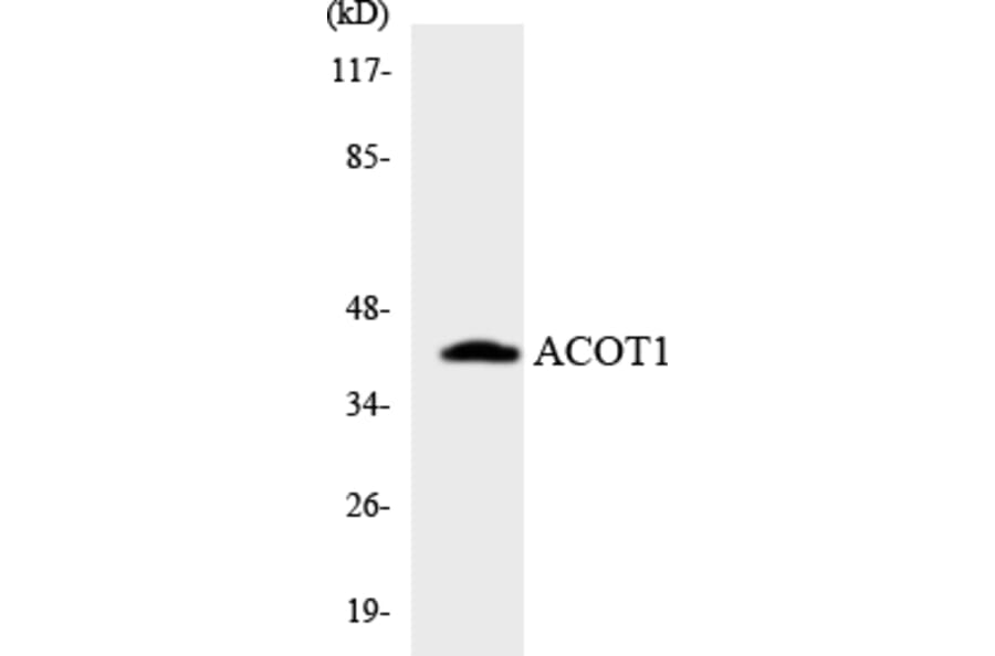 Western Blot - Anti-ACOT1 Antibody (R12-2437) - Antibodies.com